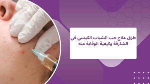 علاج حب الشباب الكيسي- دليل شامل