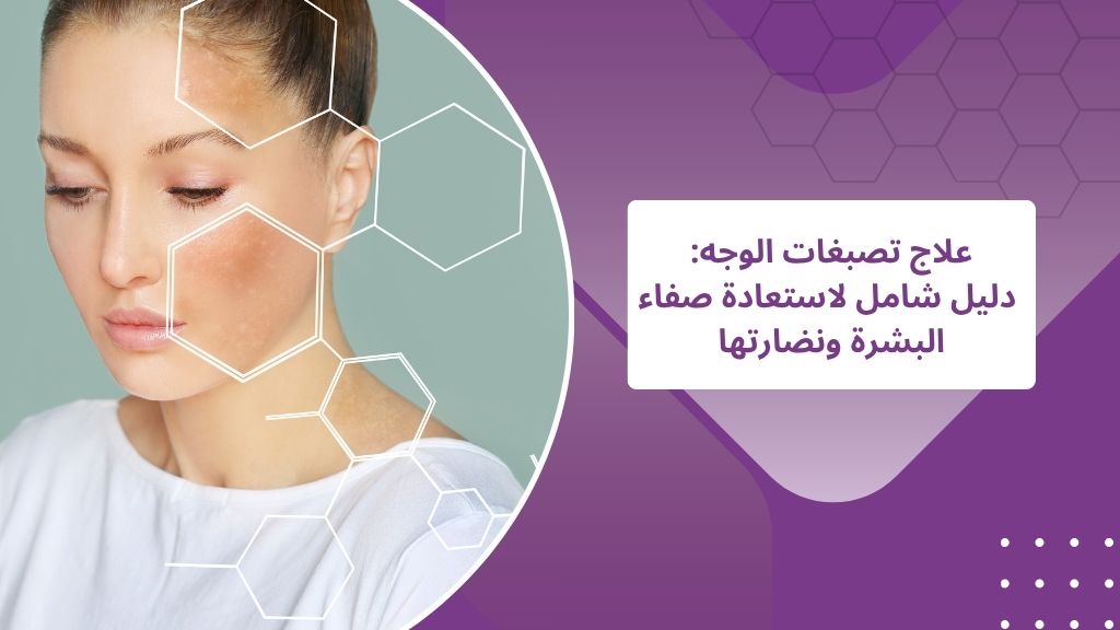 علاج تصبغات الوجه في الشارقة ودبي دليل شامل