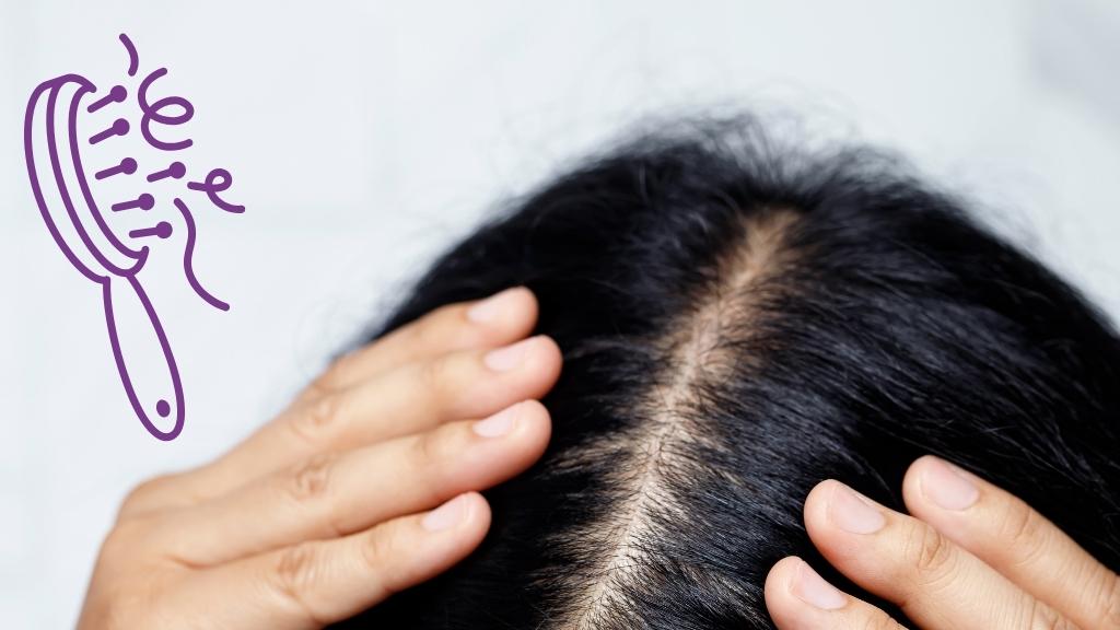 علاج الصلع الوراثي للنساء في دبي والشارقة