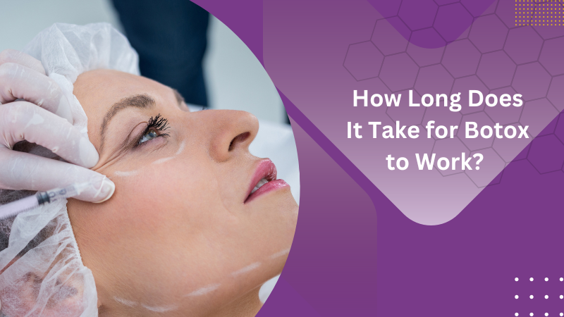 How Long Does It Take for Botox to Work?