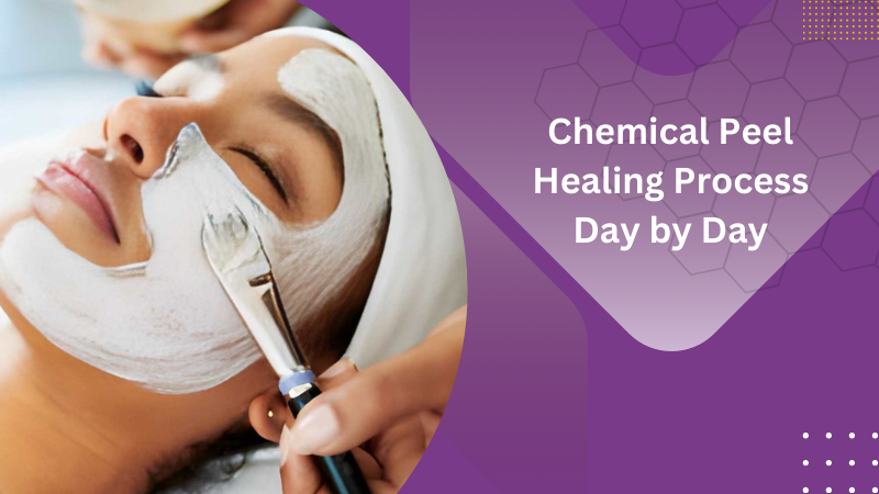 A complete guide to the chemical peel healing process day by day