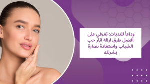 هل تعبتِ من إخفاء عيوب بشرتك؟ اكتشفي أحدث طرق إزالة آثار حب الشباب في عيادة بيلافي. حلول طبية متقدمة تعيد لكِ الثقة والنعومة.