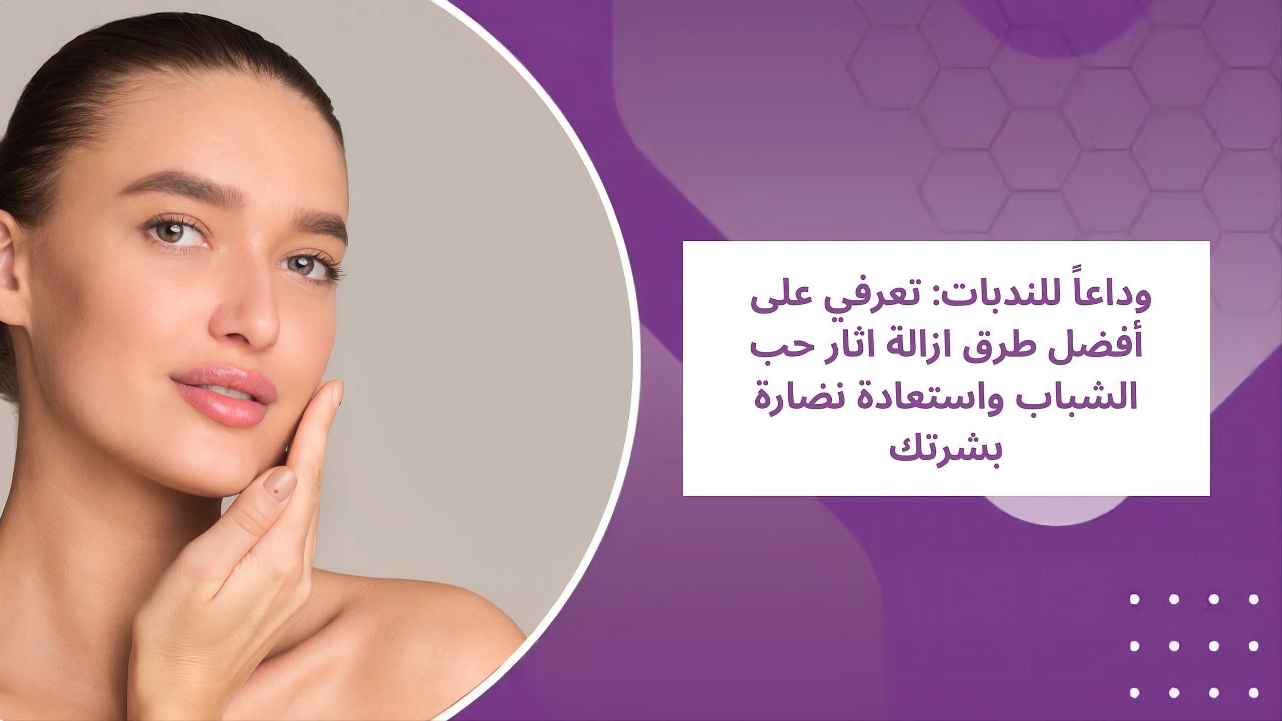 هل تعبتِ من إخفاء عيوب بشرتك؟ اكتشفي أحدث طرق إزالة آثار حب الشباب في عيادة بيلافي. حلول طبية متقدمة تعيد لكِ الثقة والنعومة.