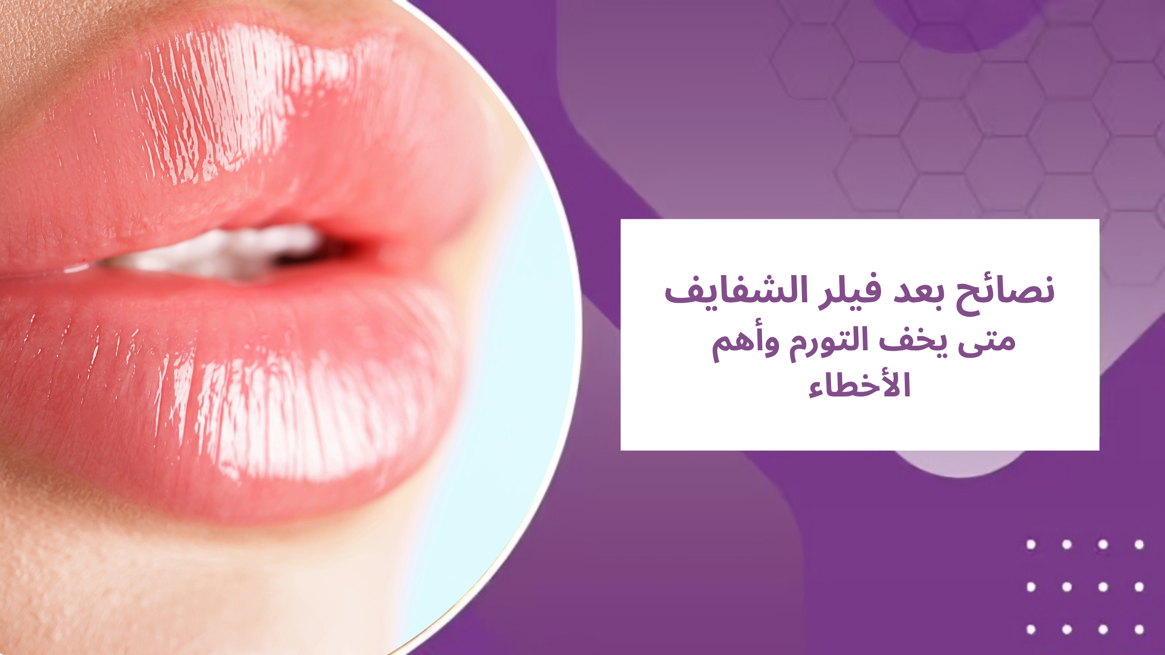 نصائح بعد فيلر الشفايف: متى يخف تورم فيلر الشفايف وأهم الأخطاء