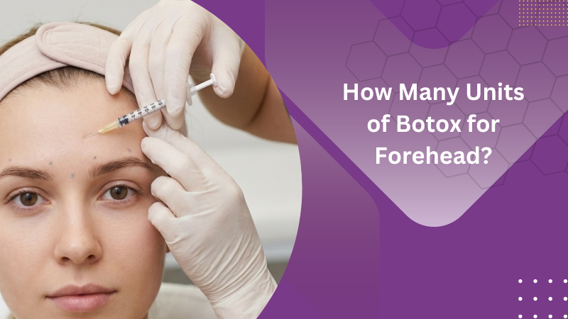 How many units of Botox for forehead?