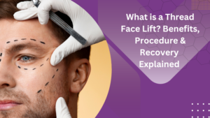 What is a Thread Face Lift? Benefits, procedure & recovery explained