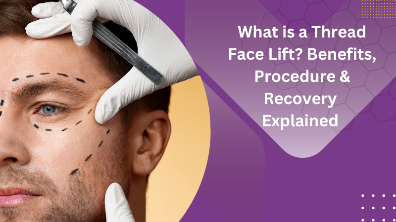 What is a Thread Face Lift? Benefits, procedure & recovery explained