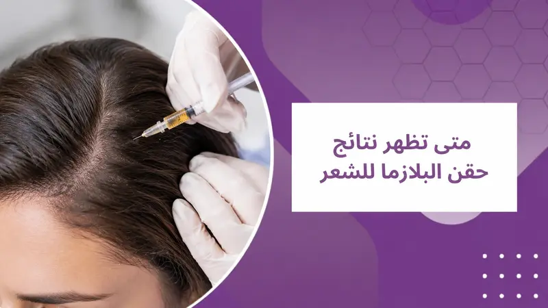 متي تظهر نتائج نتائج حقن البلازما للشعر
