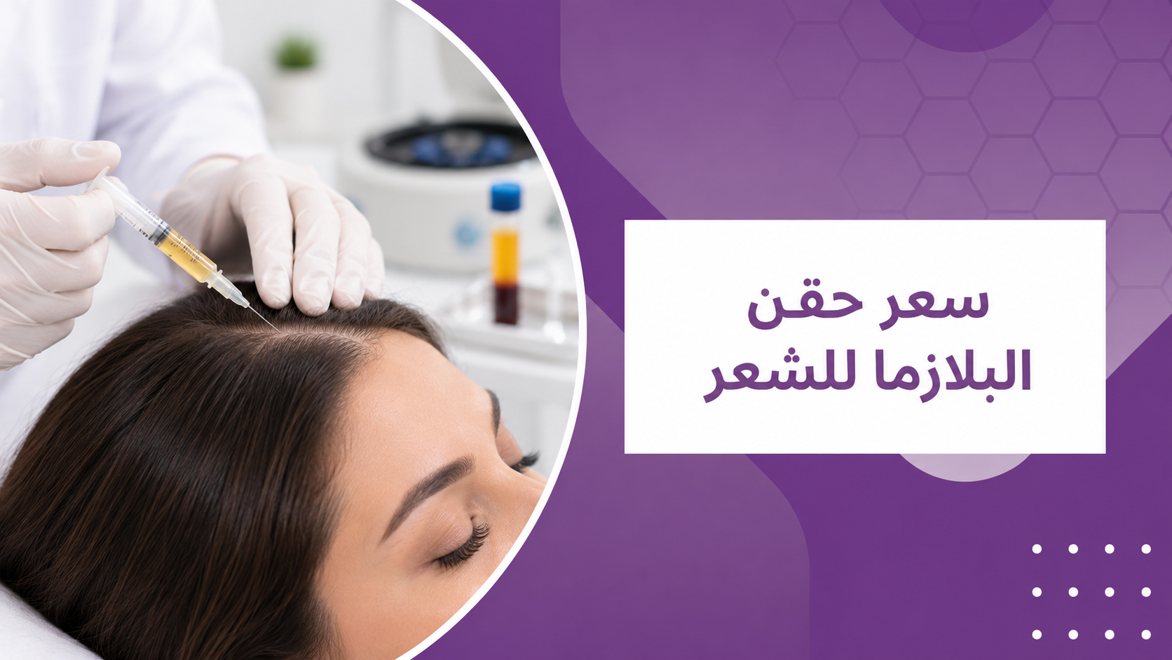 سعر حقن البلازما للشعر